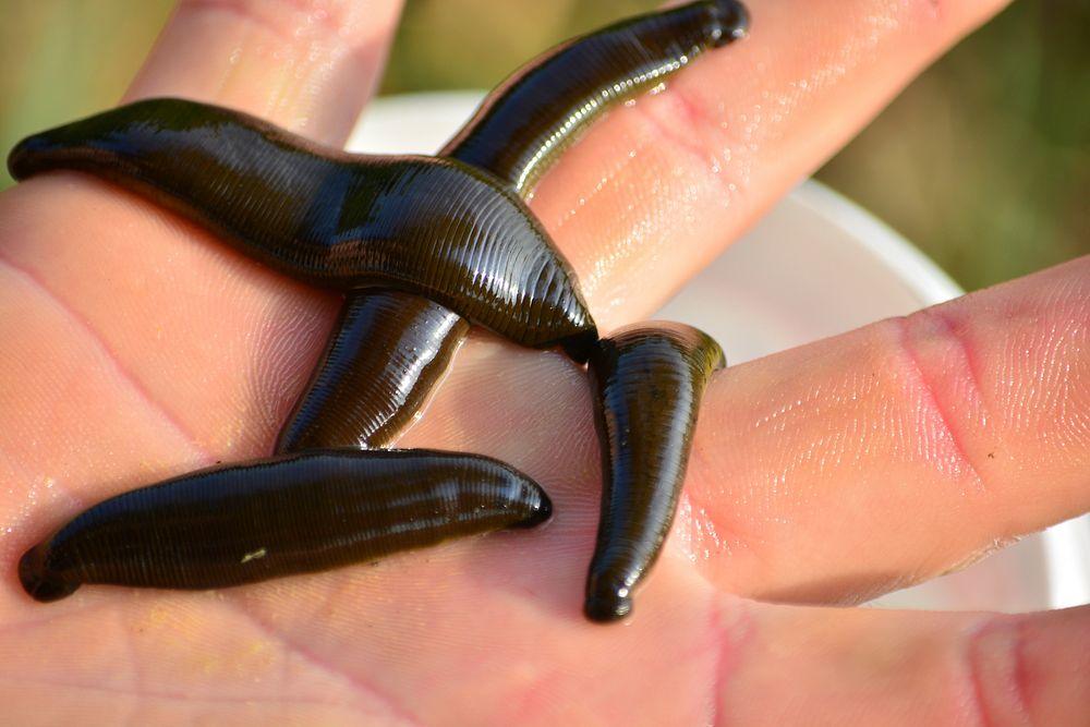 Pond Leeches: Ultimate Prevention Guide